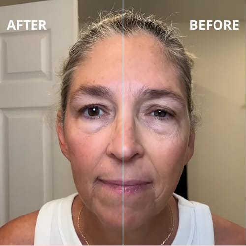 Lymphatic Face Brush